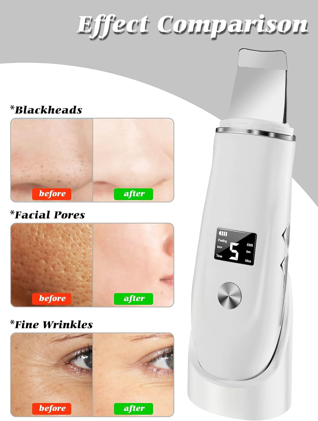 4-in-1 Ultrasonic Facial Skin Scrubber and Pore Cleaner