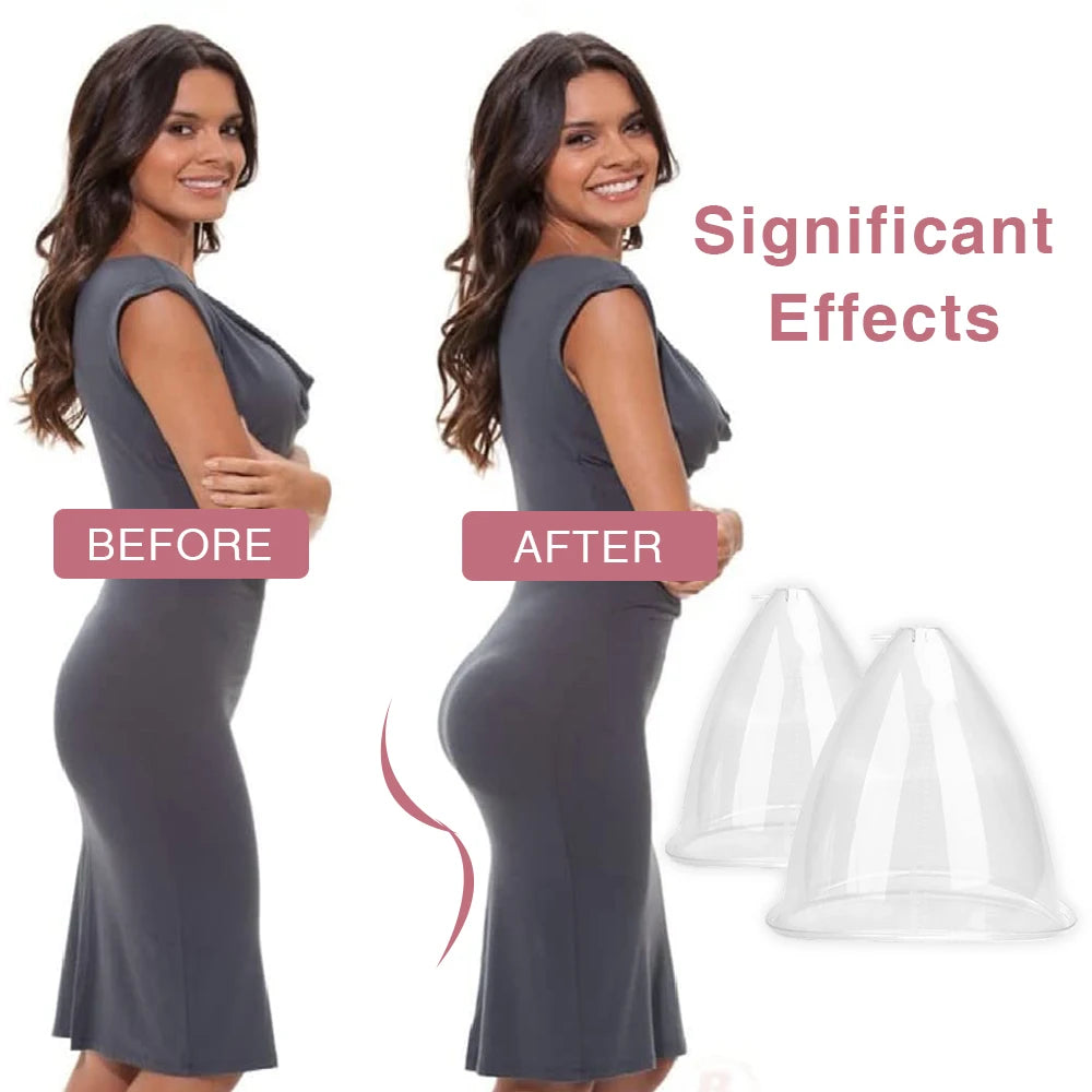 Vacuum Suction Cup Set for Breast and Buttock Enhancement - 17