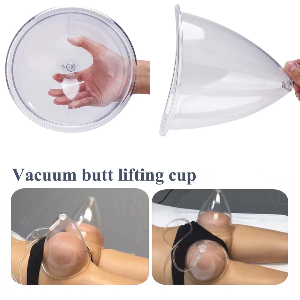 Vacuum Suction Cup Set for Breast and Buttock Enhancement - 5