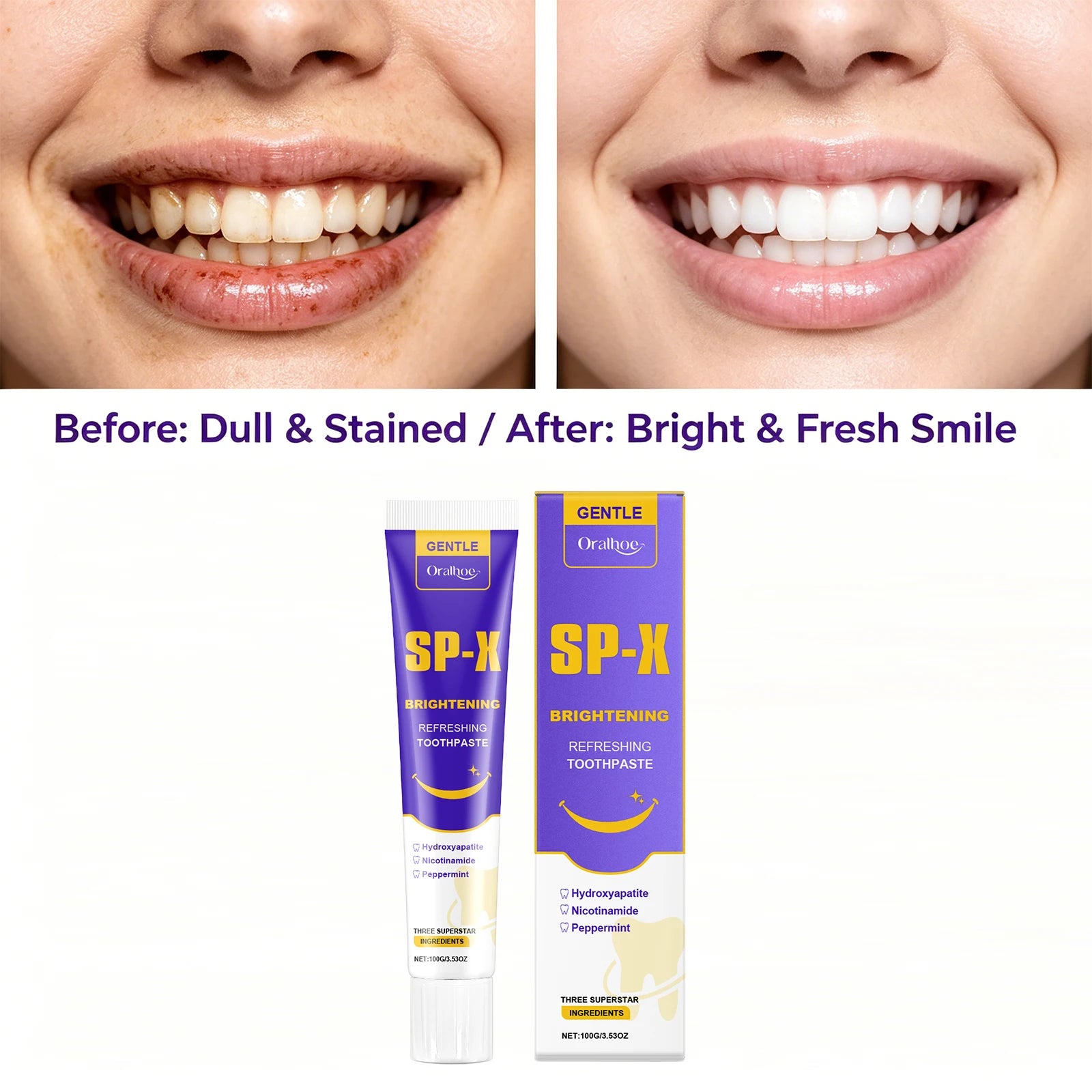 Brightening Toothpaste for Teeth Whitening and Stain Removal - 3