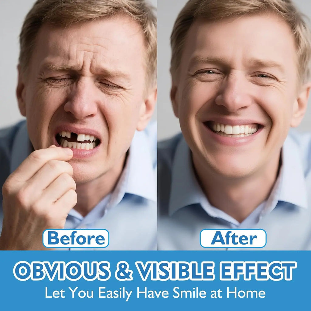 Flexible Silicone Denture Set for Natural Smile