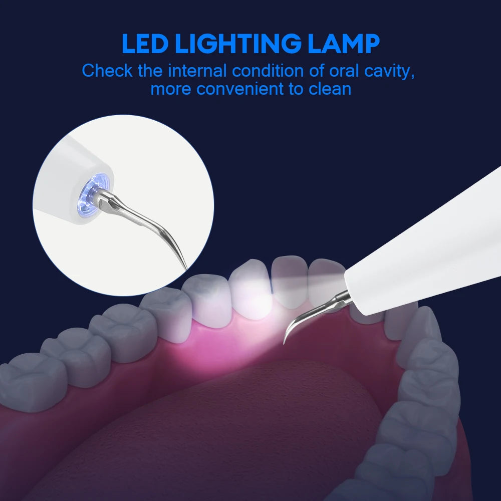 Ultrasonic Electric Teeth Tartar and Plaque Remover - 6