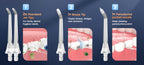 Portable Cordless Water Flosser for Teeth Cleaning