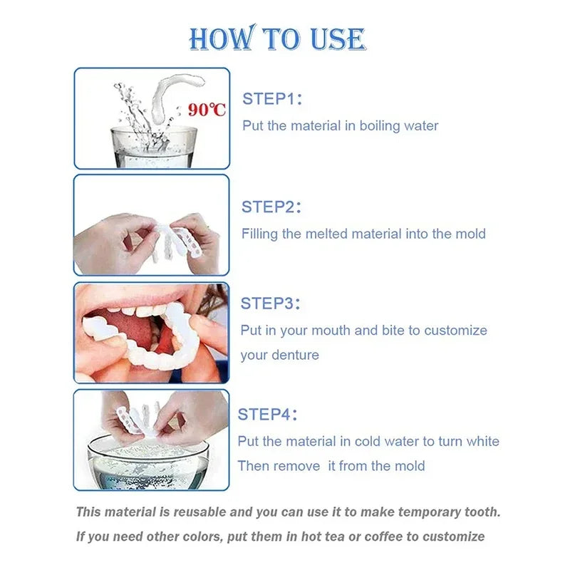 Snap-On Temporary Smile Veneers for Instant Teeth Whitening