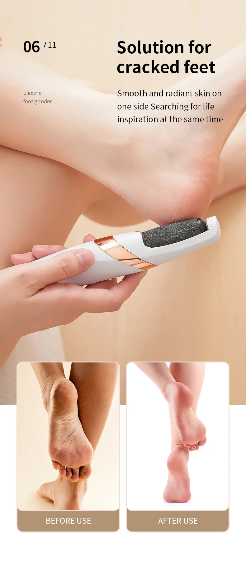 Electric Rechargeable Foot Callus Remover for Pedicure