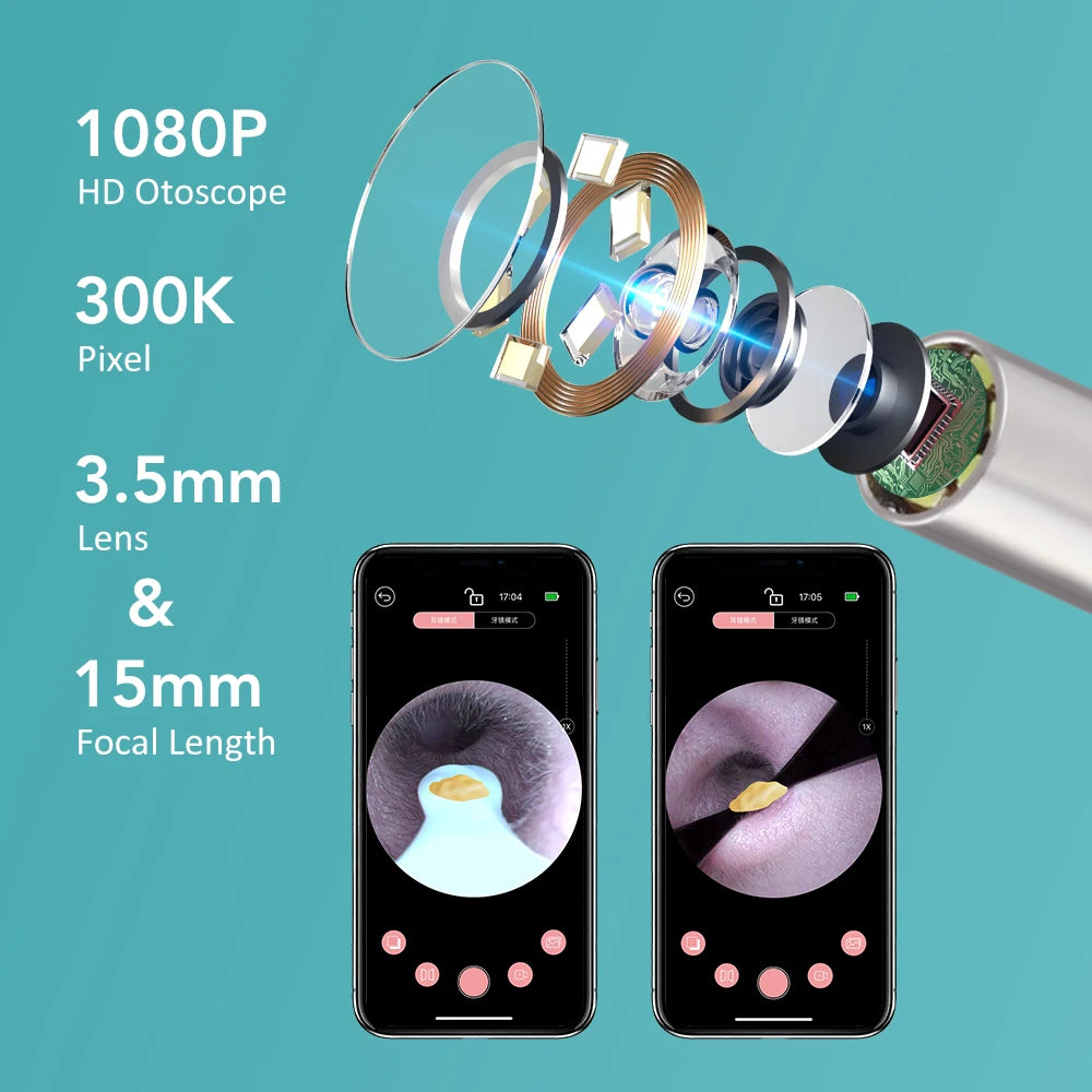 Visual Ear Wax Removal Tool with HD Camera - 10