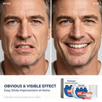 Instant Snap-On Silicone Cosmetic Dentures Set