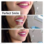 Temporary Snap-On Cosmetic Teeth Veneers Kit