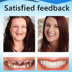 Custom Fit Silicone Comfort Dentures