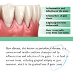 Natural Toothache and Gum Relief Drops