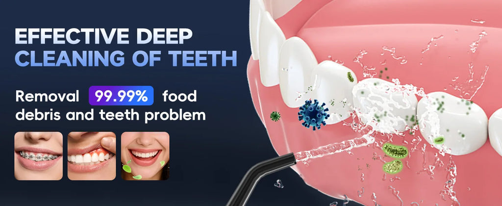 Portable Cordless Water Flosser for Teeth Cleaning