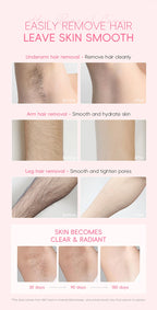 Painless Gentle Hair Removal Cream for Body and Intimate Areas