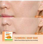 Brightening Turmeric Soap Bar for Face and Body