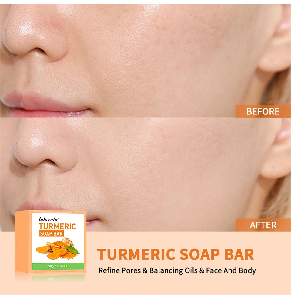 Brightening Turmeric Soap Bar for Face and Body