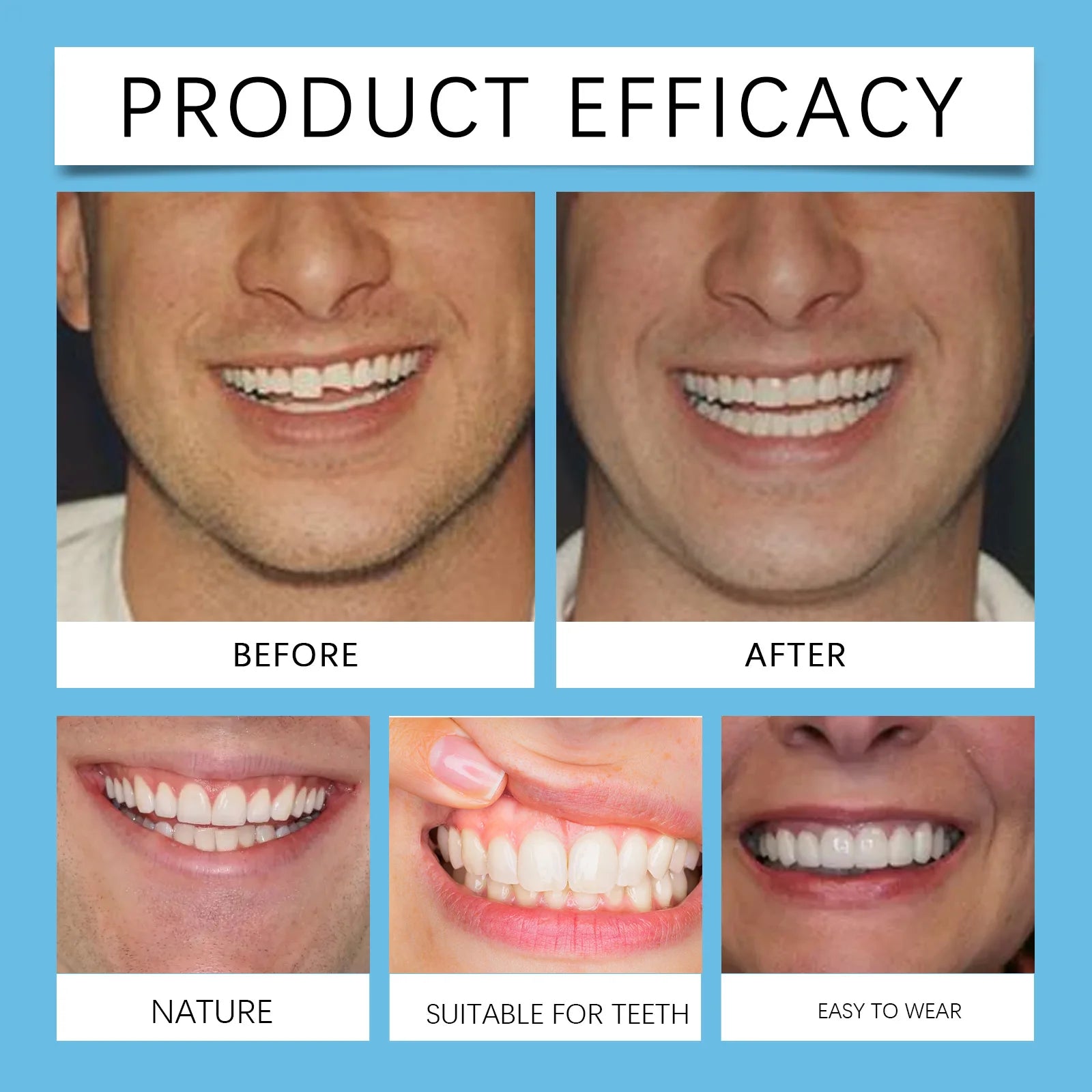Snap-On Silicone Denture Set for Instant Smile Correction - 19