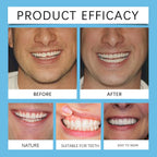 Snap-On Silicone Denture Set for Instant Smile Correction