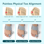 Adjustable Bunion Corrector and Toe Straightener