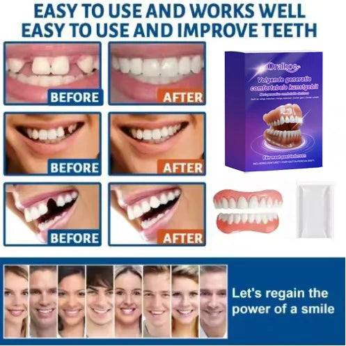 Instant Snap-On Silicone Denture Kit for Natural Smile - 3