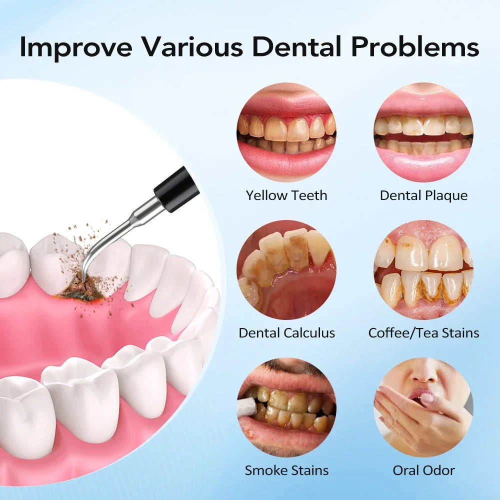 Electric Sonic Teeth Cleaner and Plaque Remover - 5