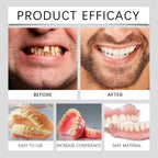 Temporary Silicone Cosmetic Denture Set for Smile Improvement