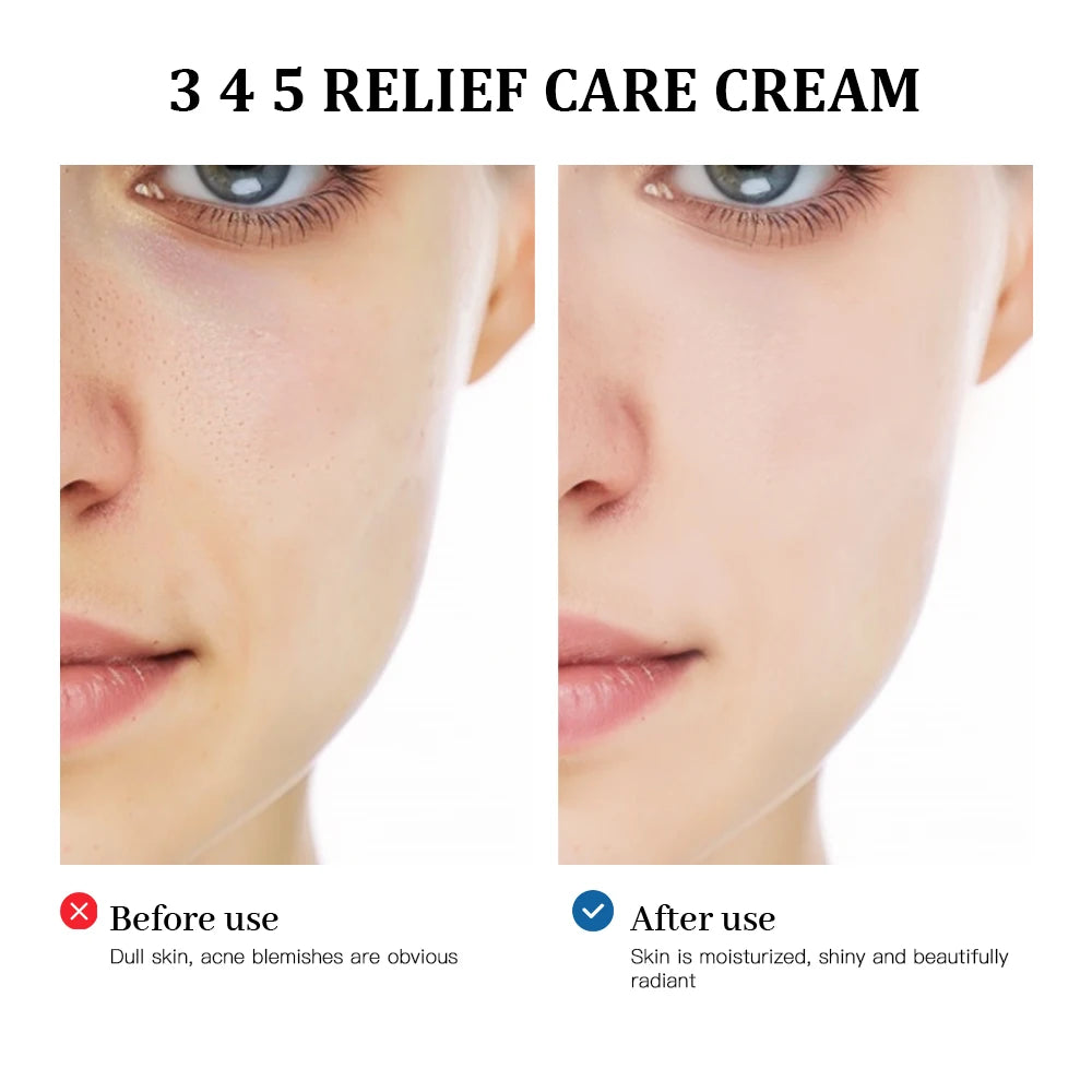 3-4-5 Relief Face Cream for Blemishes and Sensitive Skin