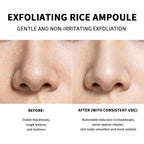 Exfoliating Rice Face Essence for Pore Cleansing and Brightening