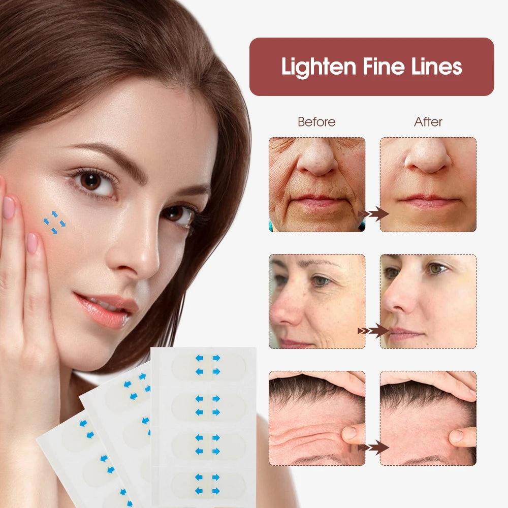 Invisible Face Lifting Patches for Instant V-Shape Firming