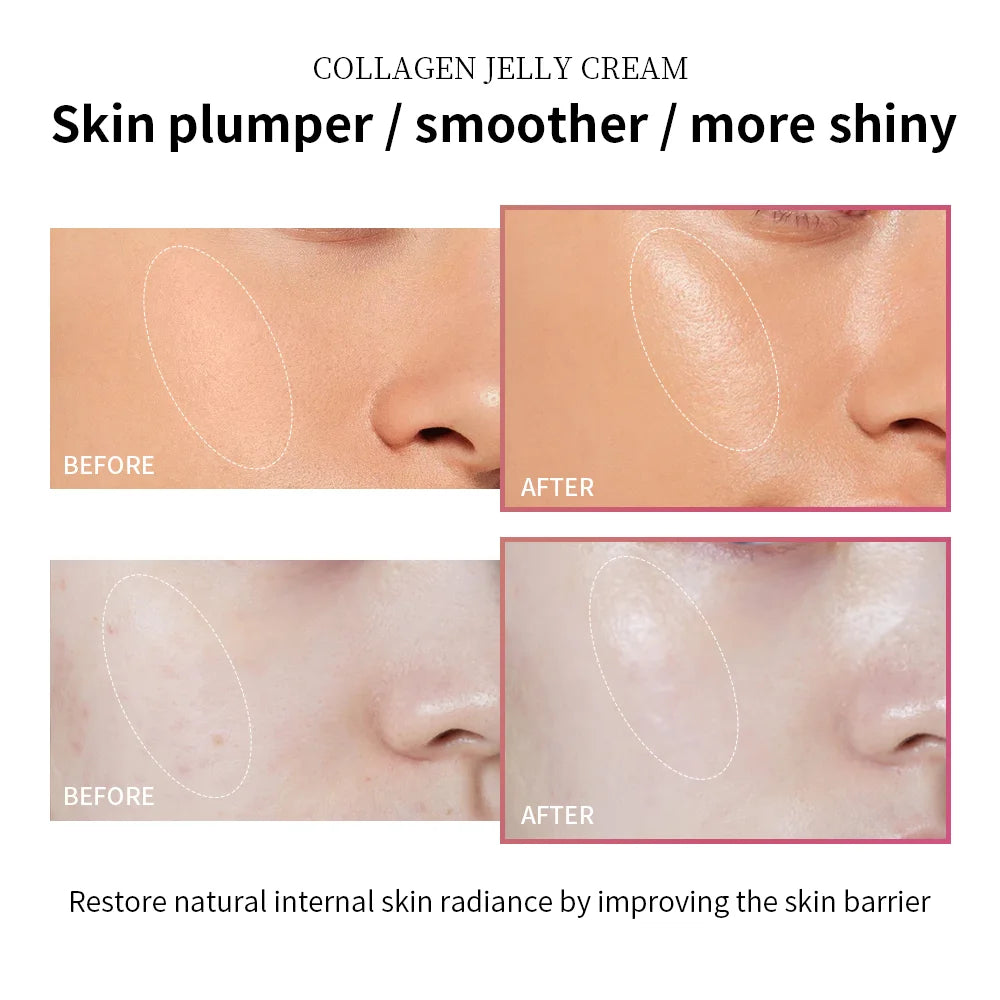 Collagen Jelly Cream for Firming and Hydrating Skin