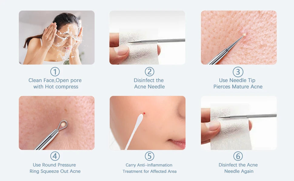 Professional Stainless Steel Blackhead and Pimple Extractor Tool Kit - 19