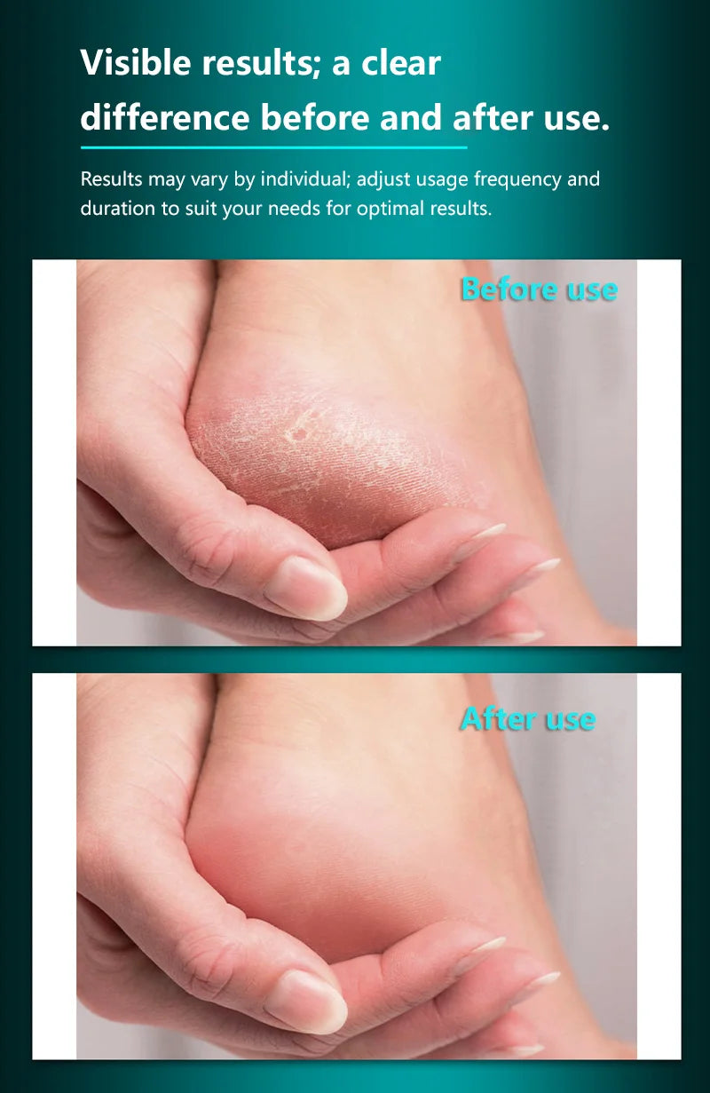 Professional Stainless Steel Foot File for Cracked Heels and Calluses