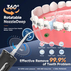 Portable Cordless Water Flosser for Teeth Cleaning