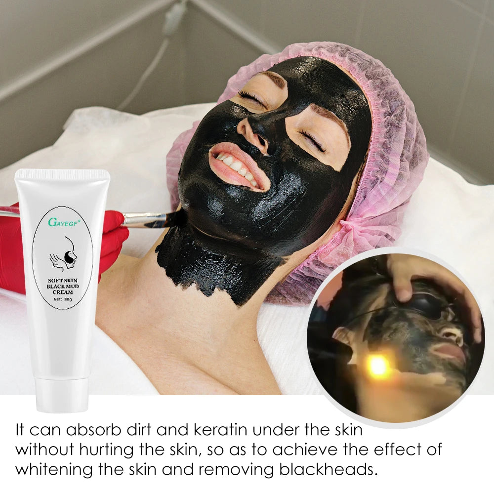 Carbon Laser Gel for Facial Deep Cleansing and Skin Rejuvenation
