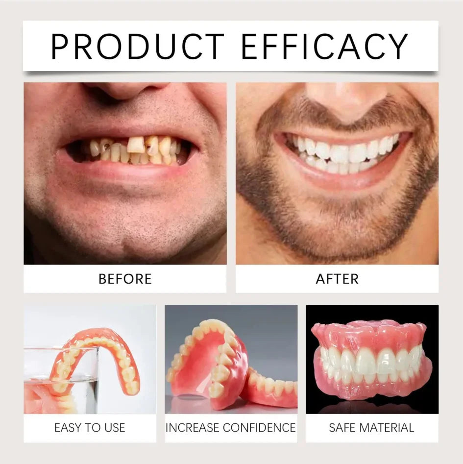 Instant Smile Resin Dentures Full Mouth Set