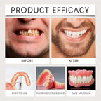 Instant Smile Resin Dentures Full Mouth Set