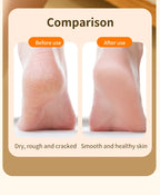 Electric Rechargeable Foot Callus Remover for Pedicure