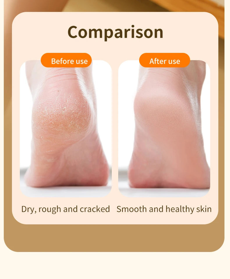 Electric Rechargeable Foot Callus Remover for Pedicure