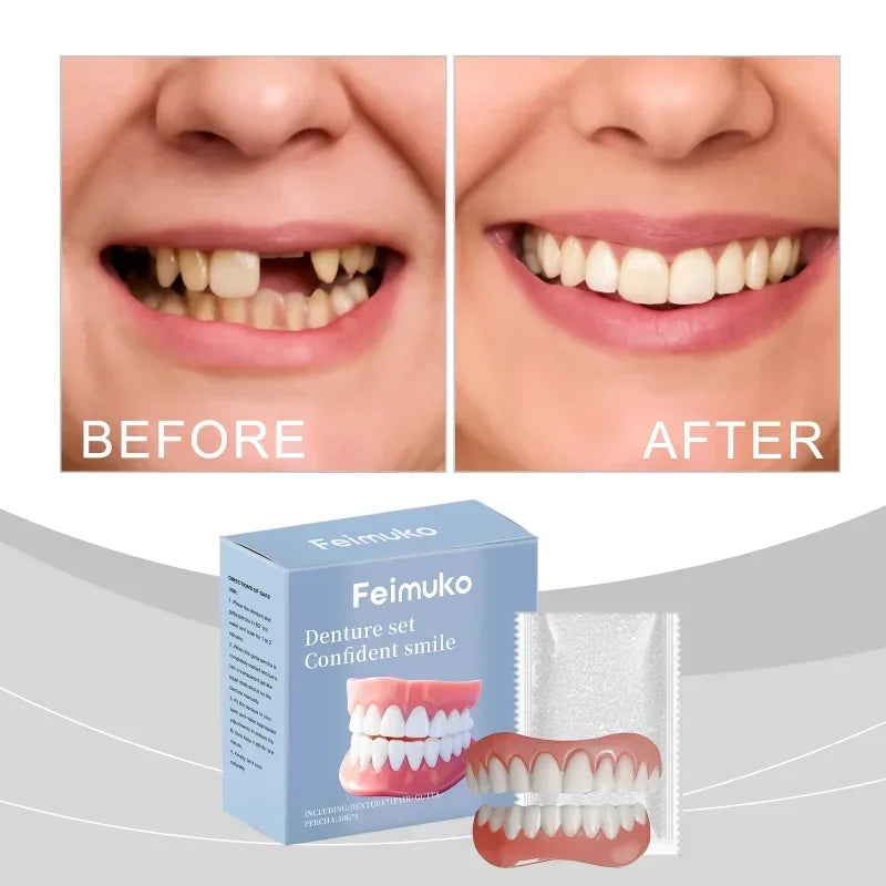 Temporary Silicone Dentures for Instant Smile Correction - 1