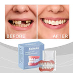 Temporary Silicone Dentures for Instant Smile Correction