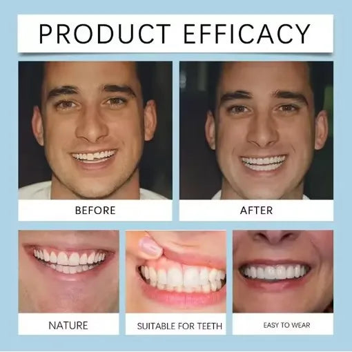 Flexible Silicone Denture Set for Instant Natural Smile