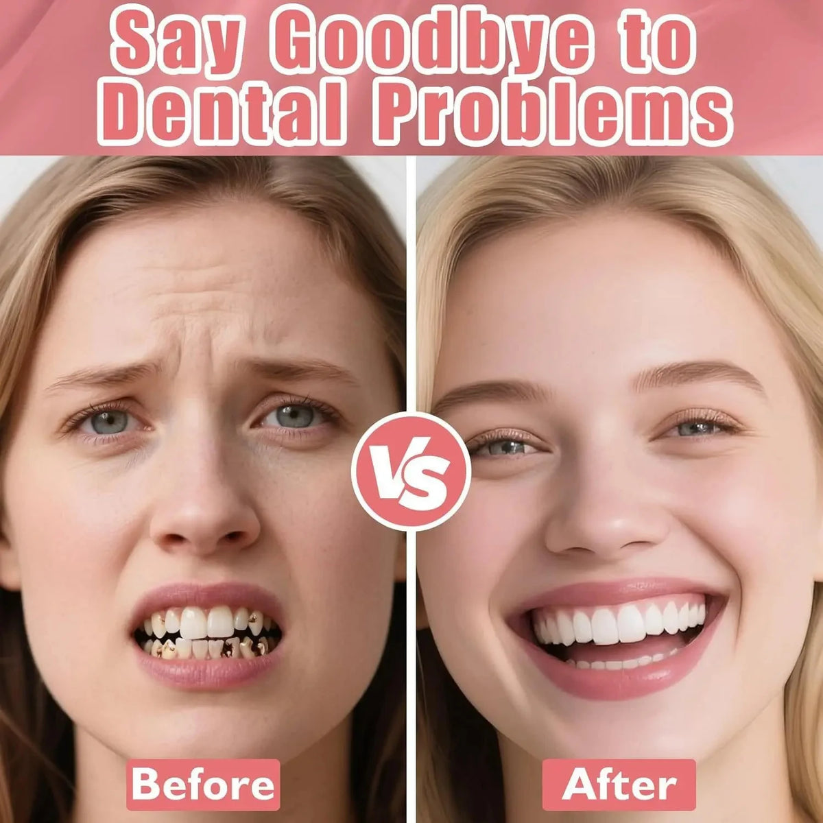 Realistic Temporary Denture Set for Confident Smile
