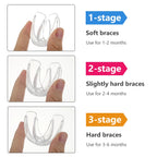 3-Stage Kids Dental Orthodontic Alignment Trainer Set