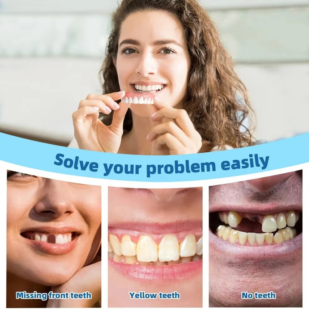 Custom-Fit Silicone Smile Veneers for Natural Looking Teeth