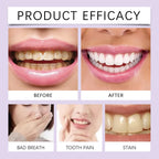 Professional Teeth Whitening and Enamel Restoration Powder