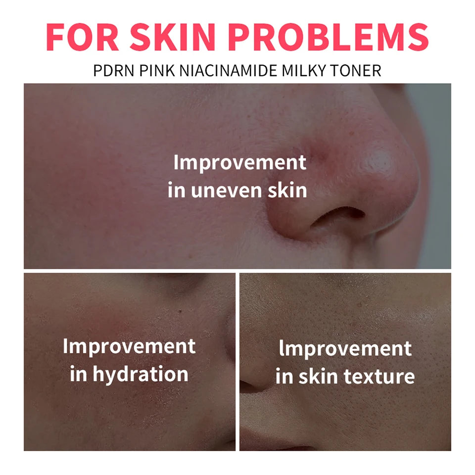 PDRN Niacinamide Milky Facial Toner for Hydrating Glowing Skin