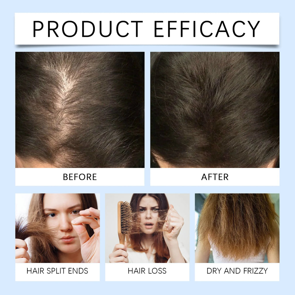 Rosemary Scalp Nourishing Hair Growth Roller