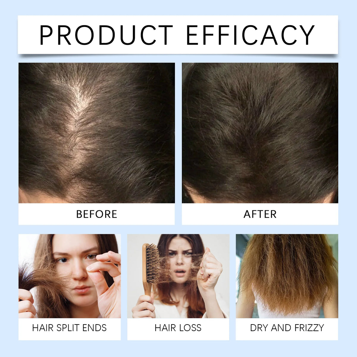 Rosemary Scalp Nourishing Hair Growth Roller