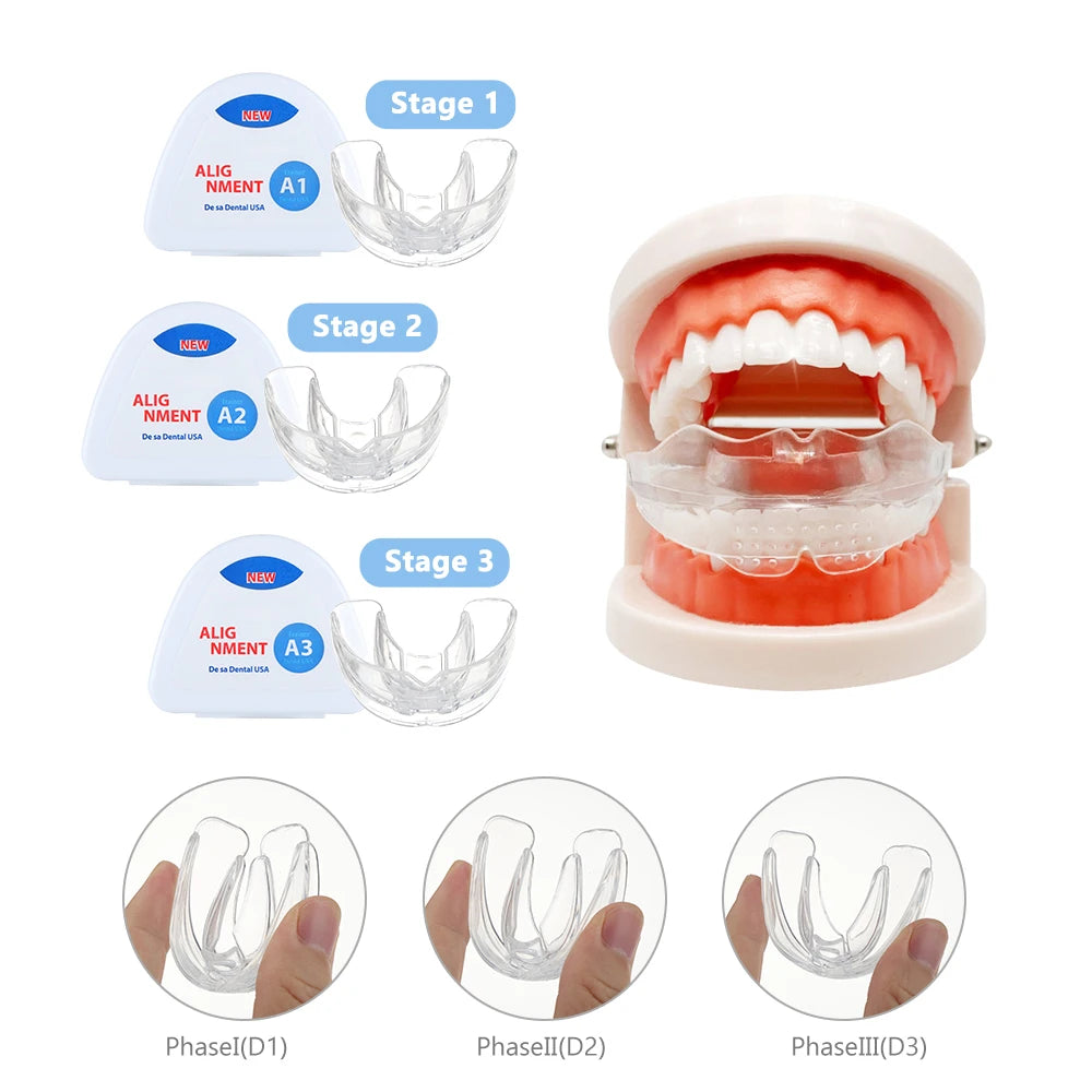 3-Stage Kids Dental Orthodontic Alignment Trainer Set