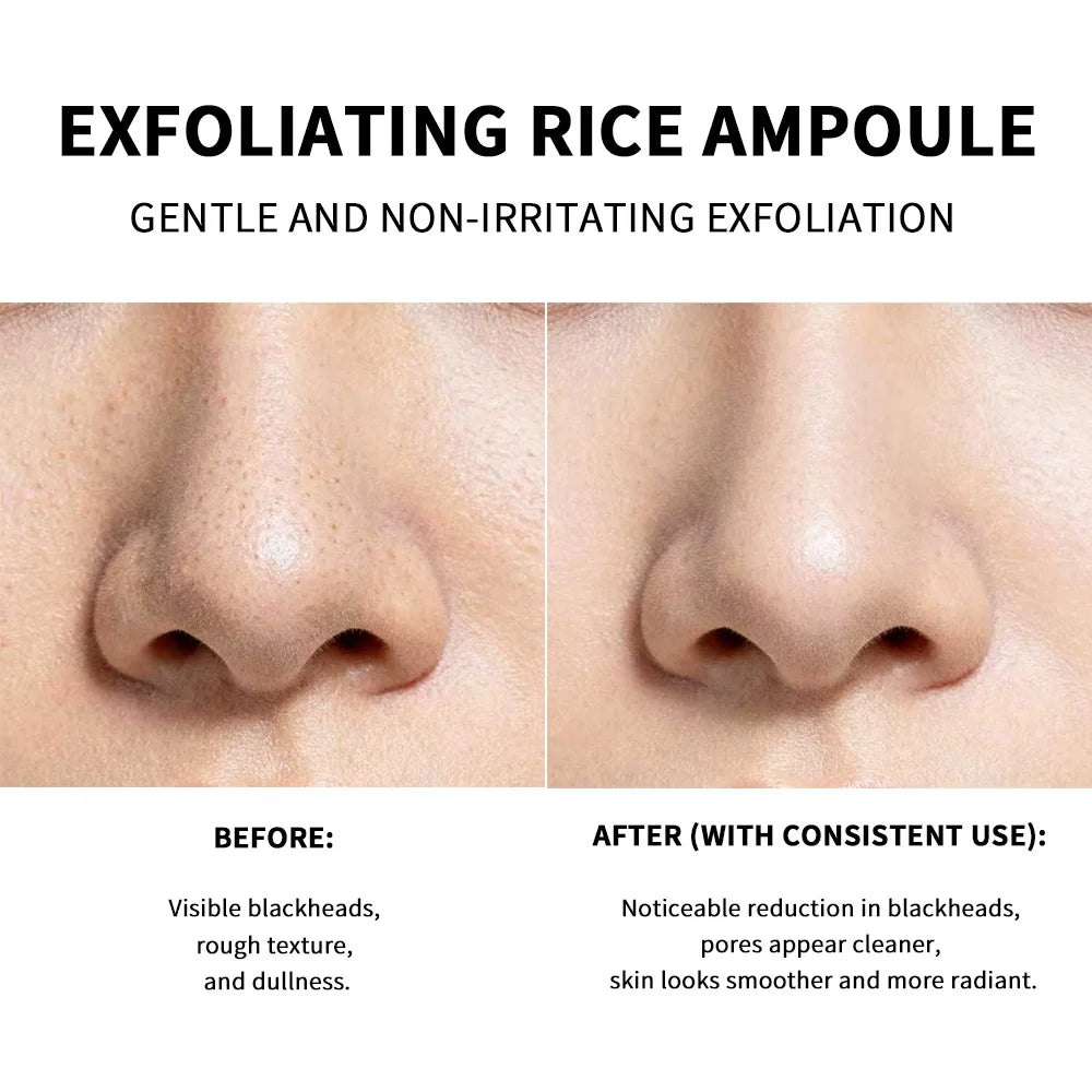 Exfoliating Rice Face Essence for Pore Cleansing and Brightening