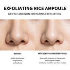 Exfoliating Rice Face Essence for Pore Cleansing and Brightening