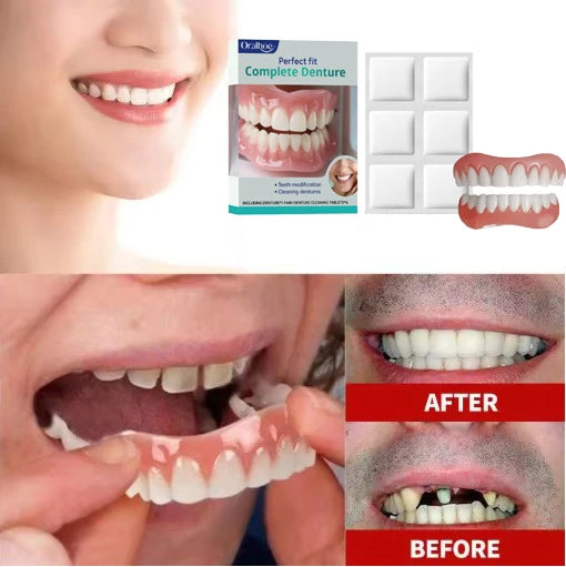 Realistic Silicone Cosmetic Teeth Veneers